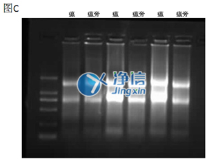 組織勻漿器對人結(jié)腸癌研磨效果